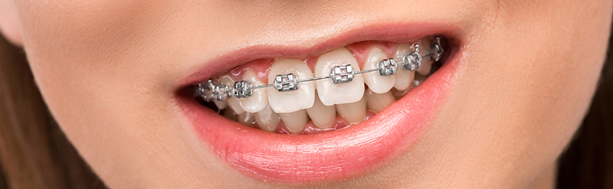Ortodoncia y Ortopedia Dentofacial